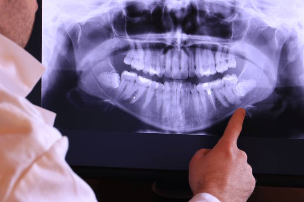 Best Emergency Root Canal Treatment in Cisco, TX